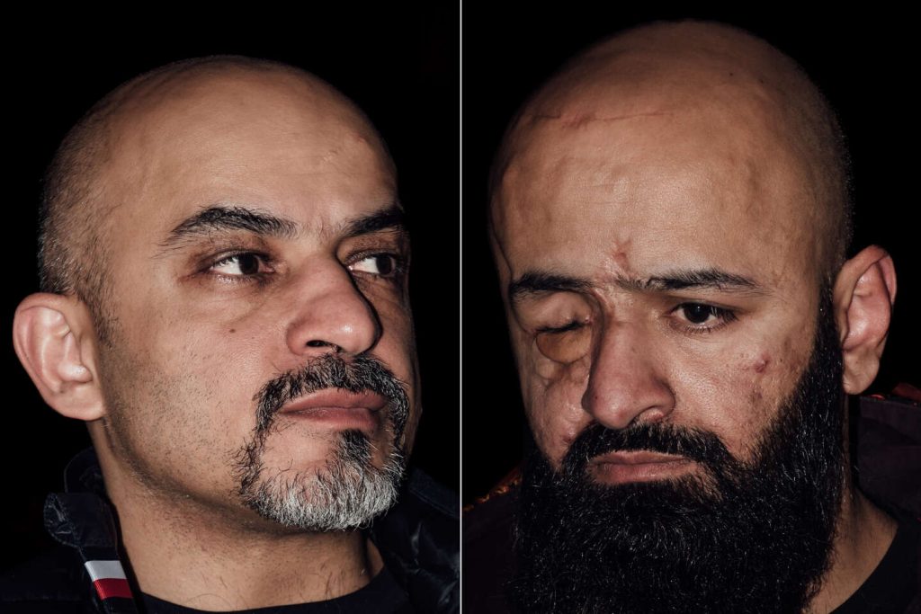 “الغزو الروسي نتيجة حتمية لثورة الميدان”