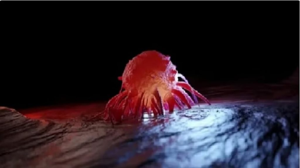 مختصة: يجب تقديم الرعاية النفسية من قبل المختصين لدعم مرضى السرطان بشكل أعمق