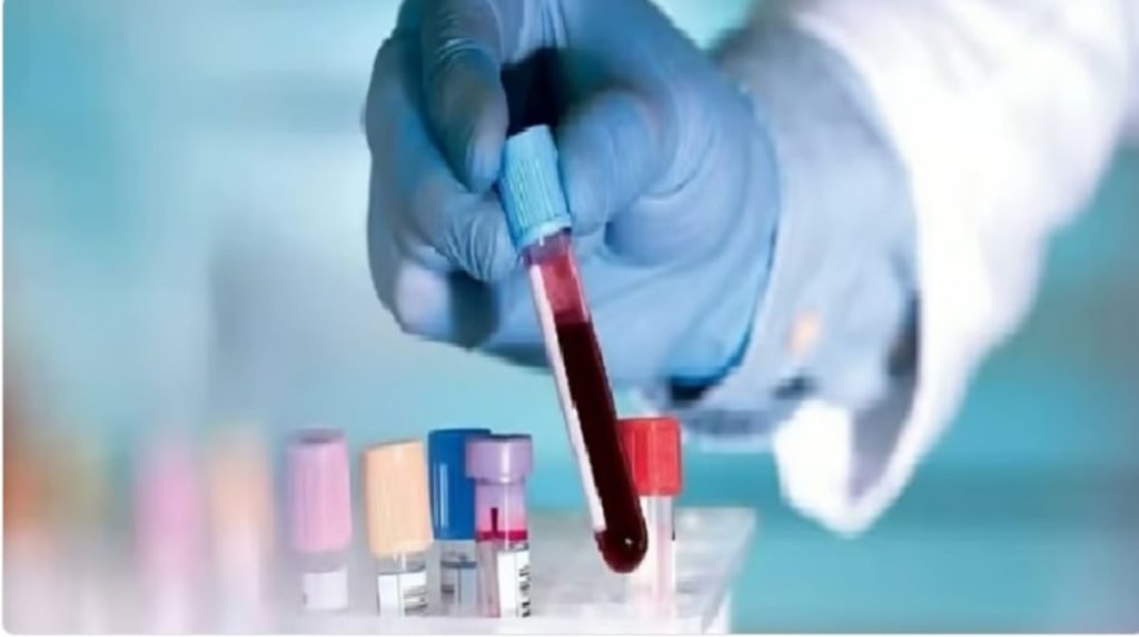 استشارية توضح التحاليل اللازم للكشف عن سبب تأخر الحمل للزوجين