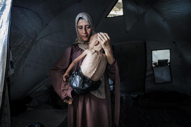 محمد زكاريا أيوب المقع ، وهو طفل لمدة عام ونصف من مدينة غزة ، يعاني من سوء التغذية الشديد ، 21 يوليو 2025.