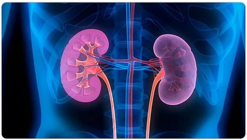 مستشفى أجياد الطوارئ يوضح طرق الوقاية من حصى الكلى