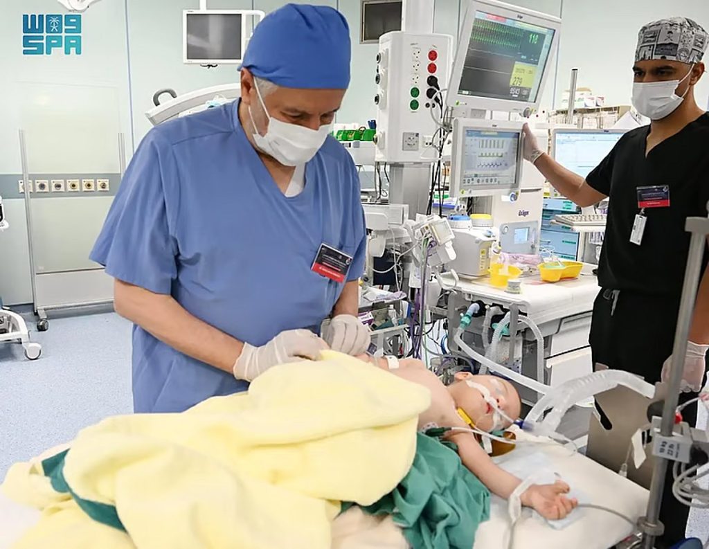 استشاري: المملكة قدمت جهودا كبيرة في فصل التوائم الملتصقة