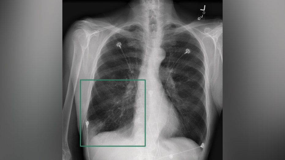 تساعد Nvidia في تحويل الرعاية الصحية من خلال تشغيل أدوات الذكاء الاصطناعي (AI) التي يمكنها المساعدة في كل ركن من أركان المستشفى تقريبًا.