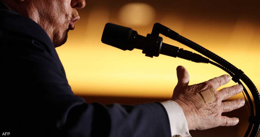 البيت الأبيض يفسر “ضمادة ترامب”.. لماذا يلصقها على يده؟