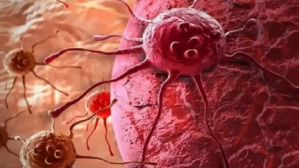 استشارية جراحة أورام تحذر من 3 أخطار