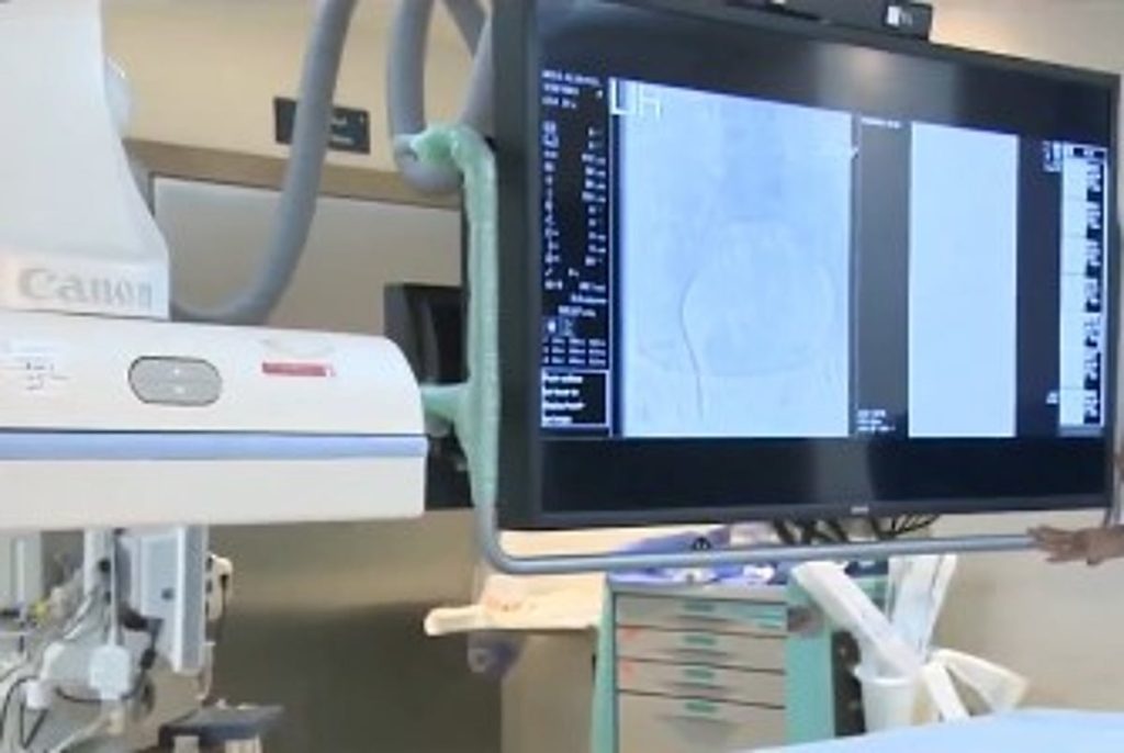 استشاري: التصوير التداخلي في حالات السكتات الدماغية والنزيف يغني عن التدخل الجراحي