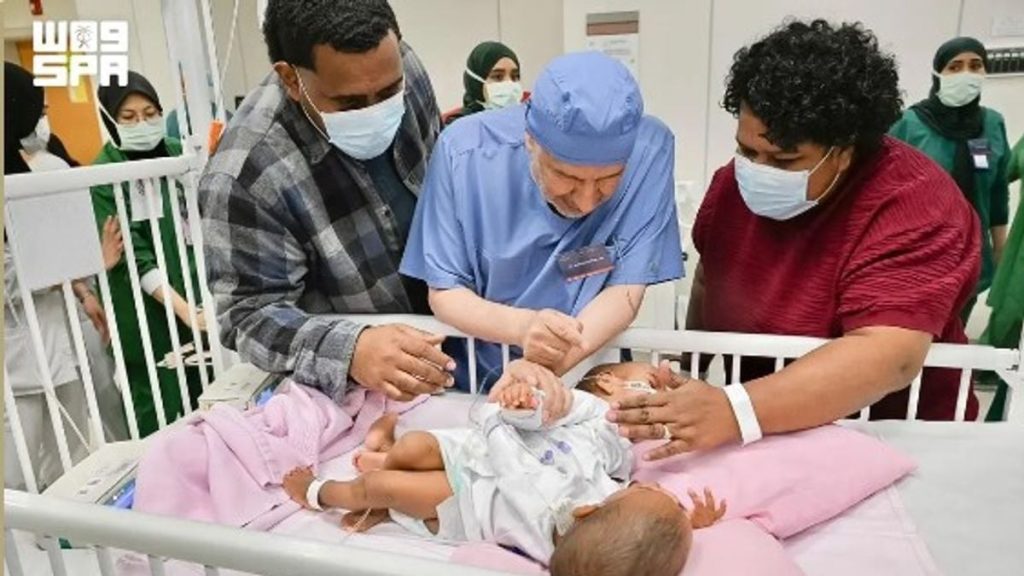 إنفاذًا لتوجيهات خادم الحرمين وولي العهد.. بدء عملية فصل التوأم الملتصق الفيجي "جسبيلي وديسيسيا"